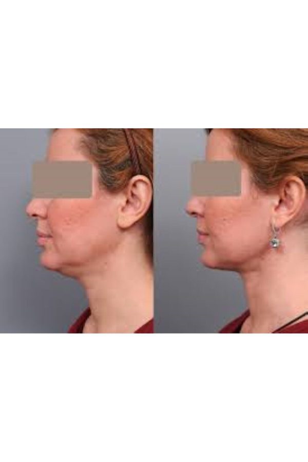 سرم پوست اورجینال برند Dr کد 797270918 - Image 2