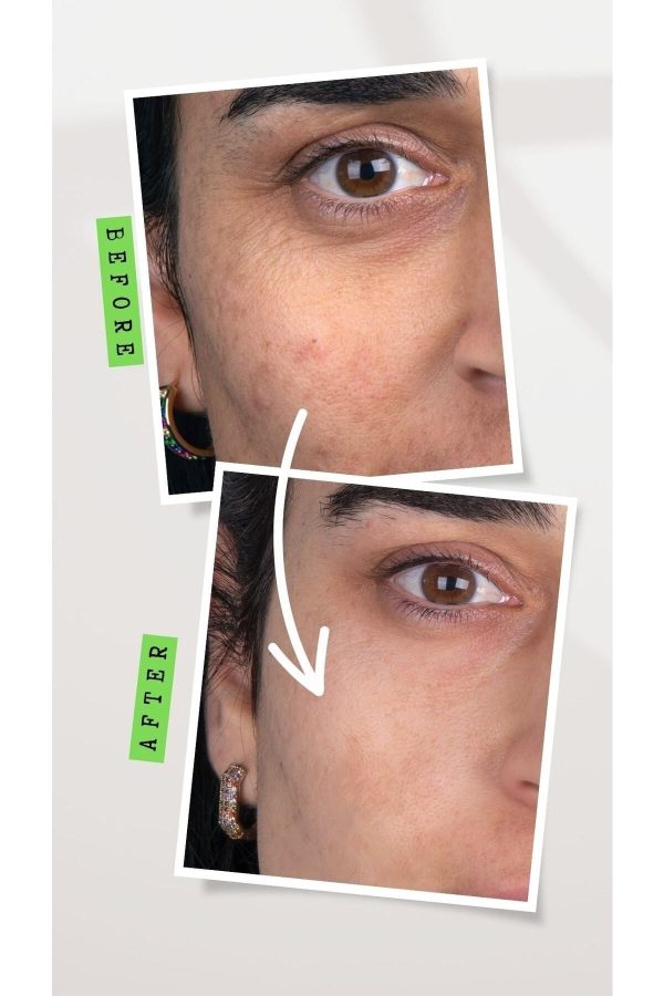 ماسک صورت اورجینال برند Ecoprobiotic کد 677265376 - Image 5