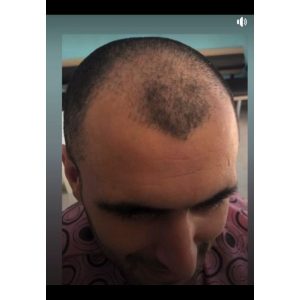 ست مراقبت از مو اورجینال برند Fiora کد 807074682