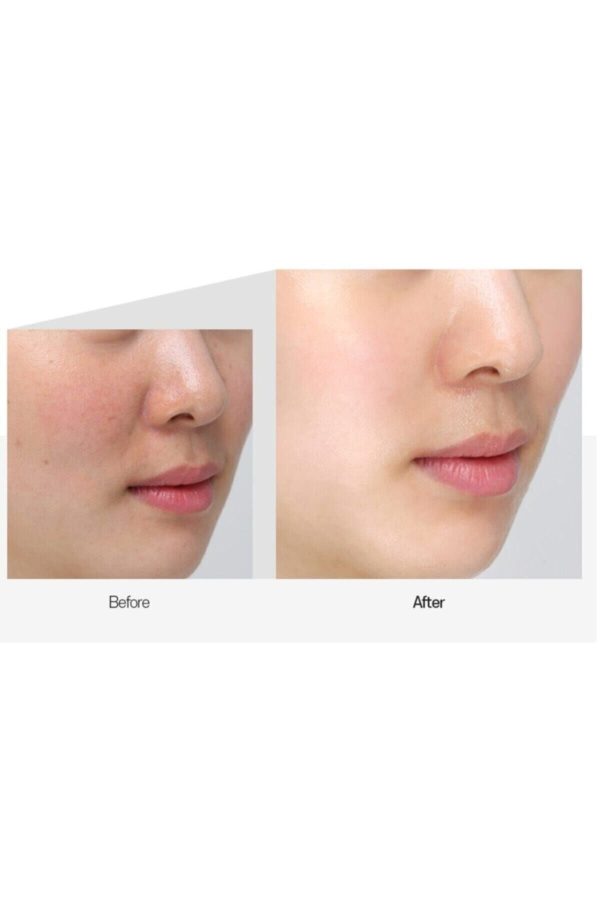 سرم پوست اورجینال برند Medipeel کد 38019608 - Image 2