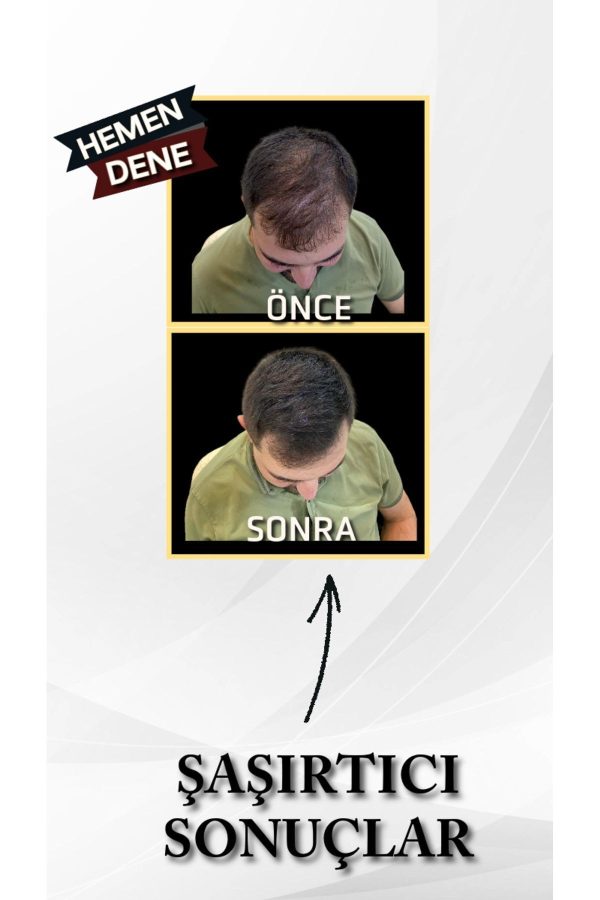 رنگ مو اورجینال برند Hairboost کد 788414774 - Image 2