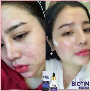 سرم پوست اورجینال برند Hill biotin expert کد 784235977