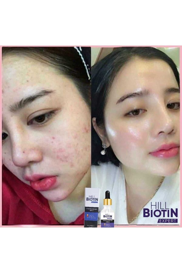 سرم پوست اورجینال برند Hill biotin expert کد 784235977 - Image 2