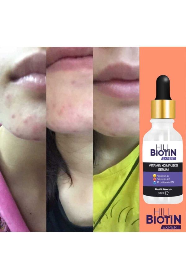 سرم پوست اورجینال برند Hill biotin expert کد 784235977 - Image 3