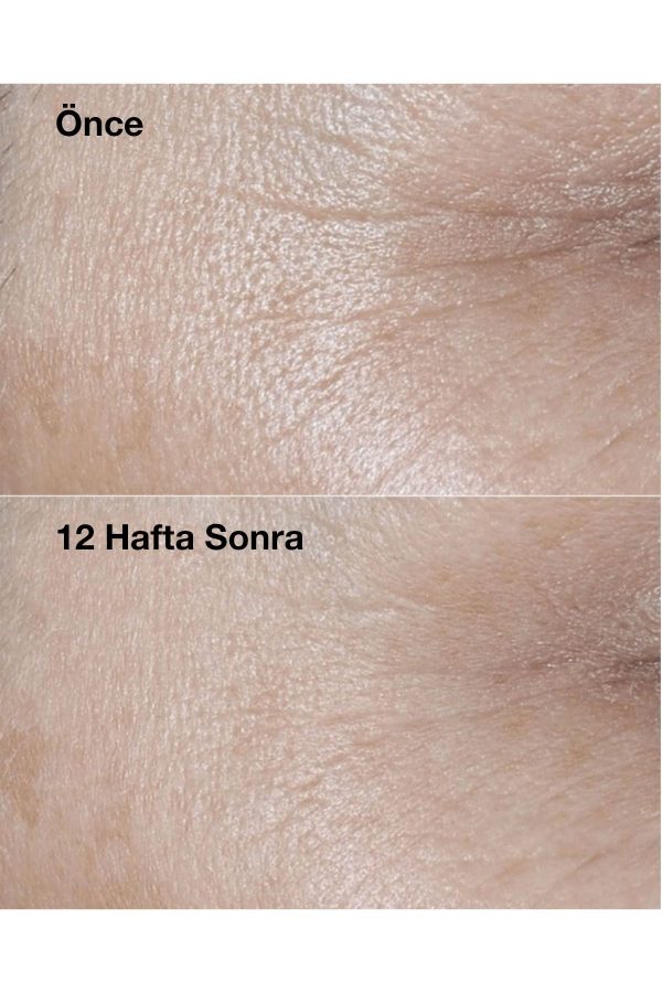 کرم صورت اورجینال برند Clinique کد 808321276 - Image 4