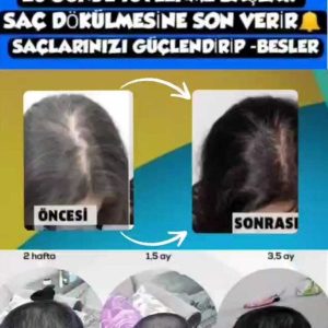 ست مراقبت از مو اورجینال برند Purexpose کد 663660309