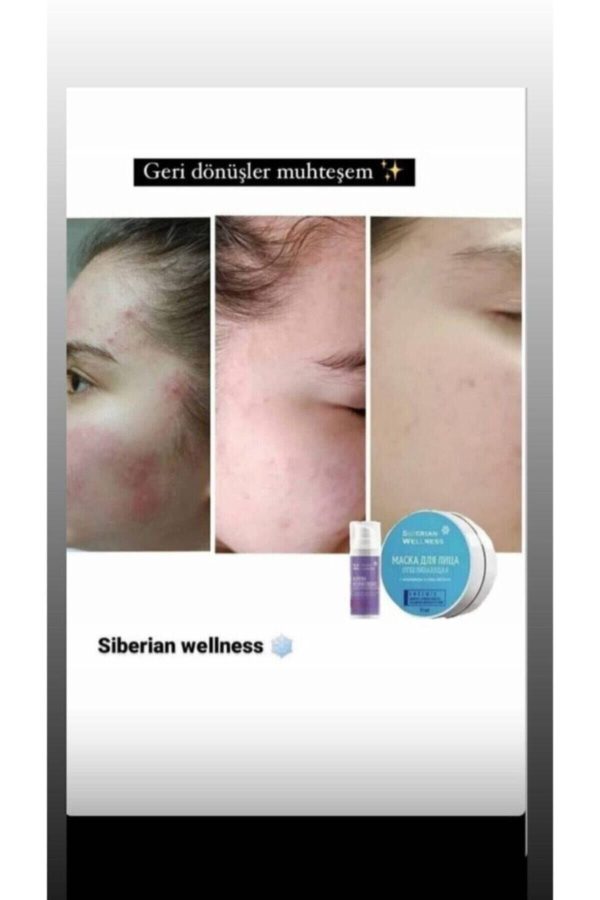 ماسک صورت اورجینال برند Siberian welness مدل Face Mask Peeling 03/2024 کد 117684541 - Image 2
