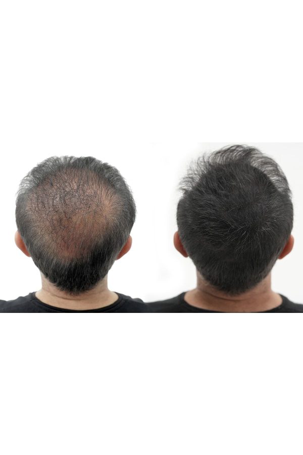 رنگ مو اورجینال برند Wollen kozmetik مدل Seyrek Kapatıcı Dip Boyası کد 648737713 - Image 2