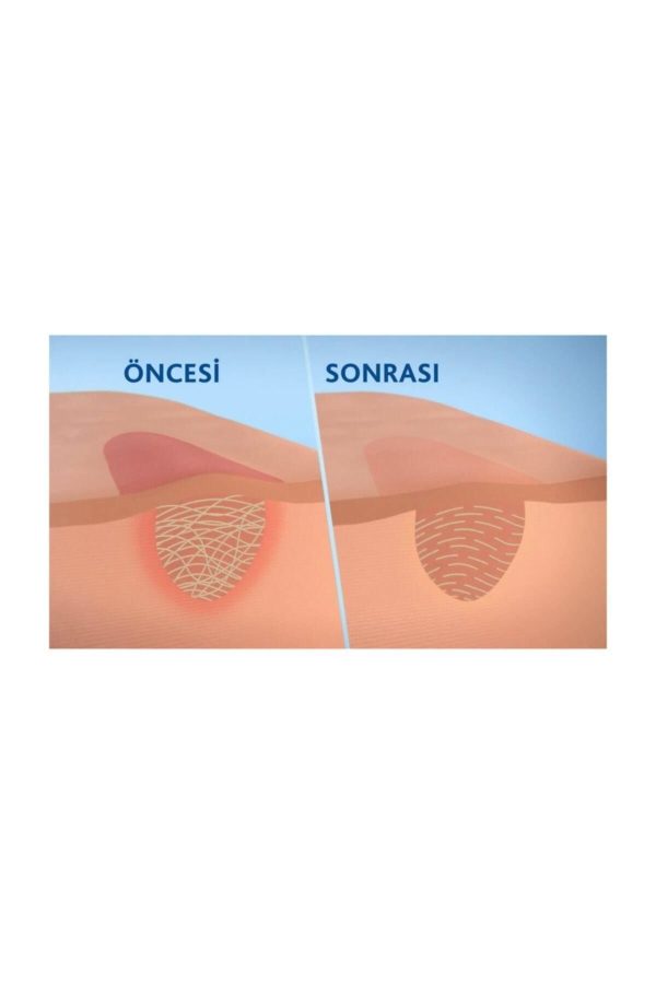 کرم بدن اورجینال برند Bepanthol مدل Anti-scar gel for Yara Izi کد 73711034 - Image 2