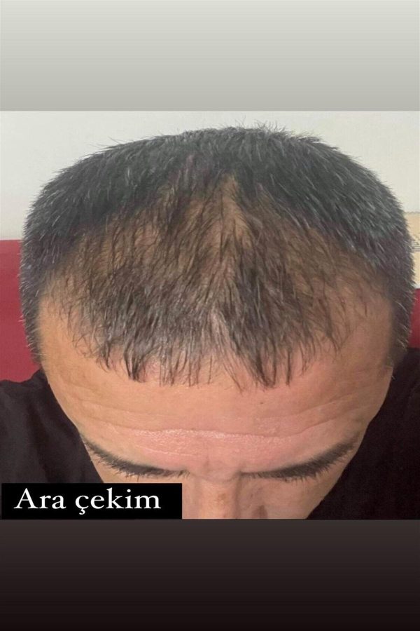 روغن و سرم مو اورجینال برند Gonul unlu کد 137144975 - Image 3