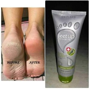 کرم پا اورجینال برند Oriflame مدل Advanced Cracked Heel Repair Cream کد 108037708