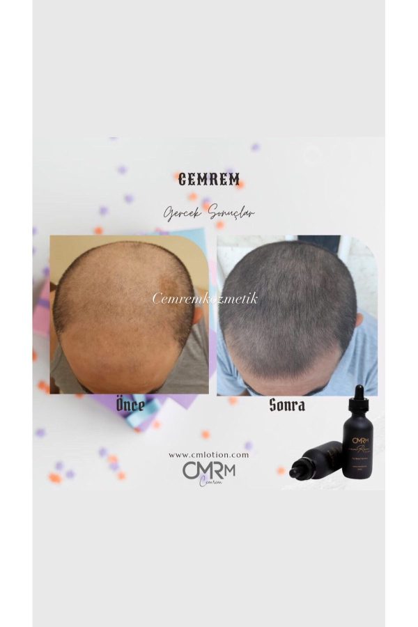 روغن و سرم مو اورجینال برند Cemremkozmetik مدل Saç Bakım Serumu کد 272141102 - Image 3