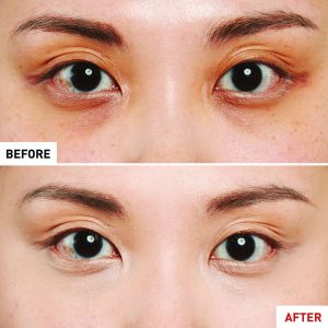 کانسیلر اورجینال برند Erborian مدل Super BB Concealer کد 848400102