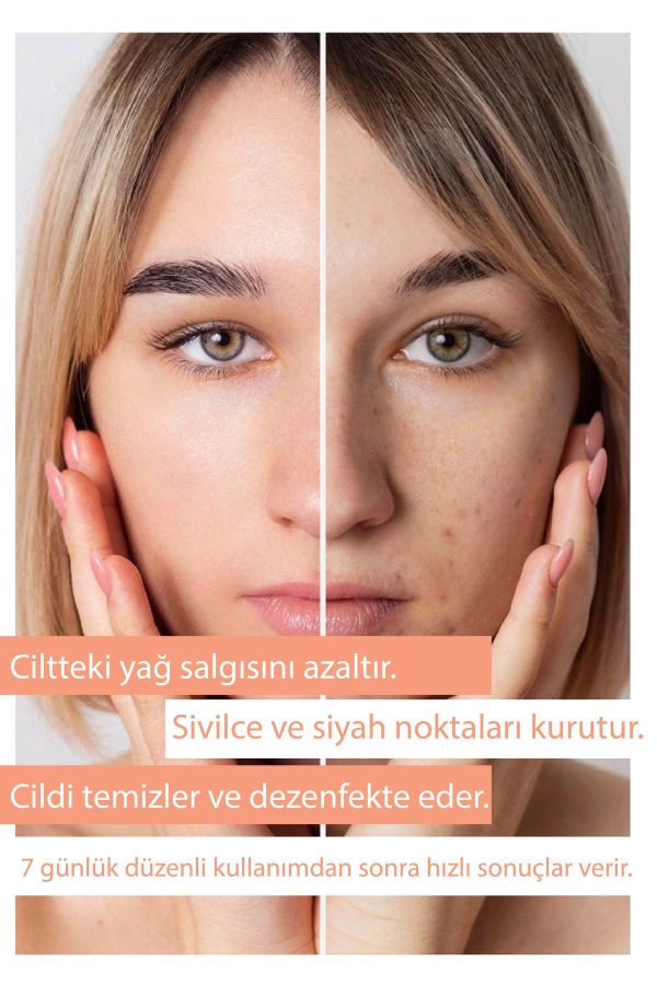کرم صورت اورجینال برند Hanuva کد 840540649 - Image 5