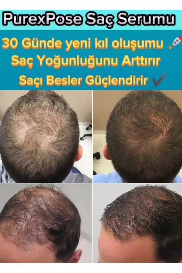ست مراقبت از مو اورجینال برند Purexpose کد 663687993 - Image 7