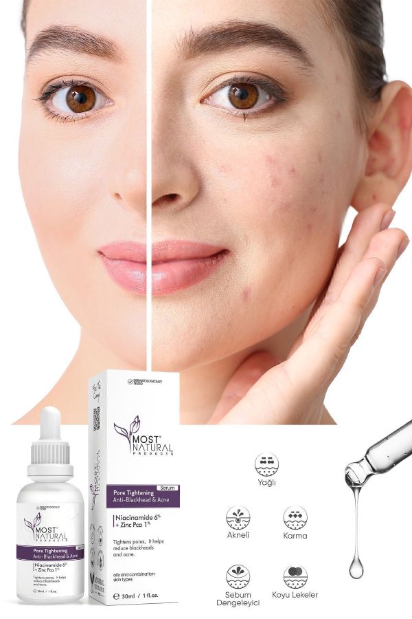 سرم پوست اورجینال برند Most natural products مدل Niacinamide Serum کد 841240254 - Image 3