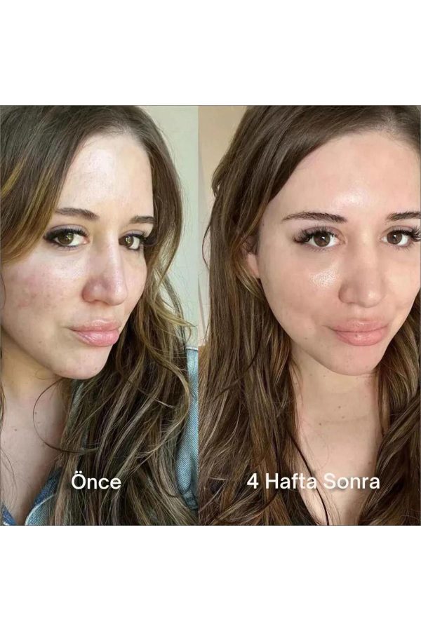 ماسک صورت اورجینال برند Missey مدل Bio Kolojen Mask کد 838229396 - Image 3