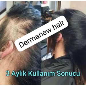 ست مراقبت از مو اورجینال برند Dermanew hair کد 127395891