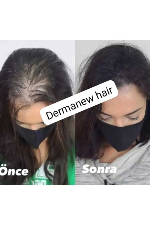 ست مراقبت از مو اورجینال برند Dermanew hair کد 127395891 - Image 4