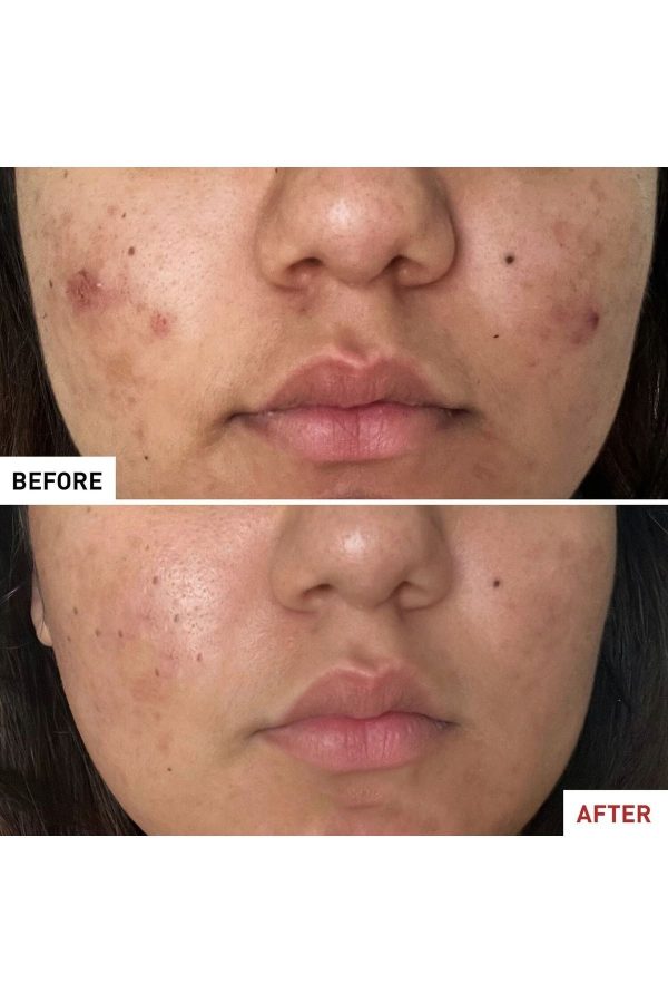 کرم صورت اورجینال برند Erborian مدل Yatıştırıcı Sıvı کد 848893386 - Image 4