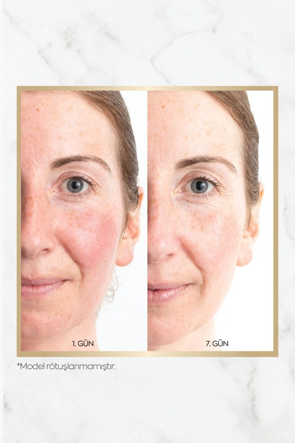 سرم پوست اورجینال برند Avon کد 801181378 - Image 6