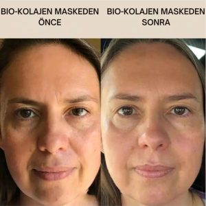 ماسک صورت اورجینال برند Gerekseal مدل Bio Kolojen Mask کد 841045484