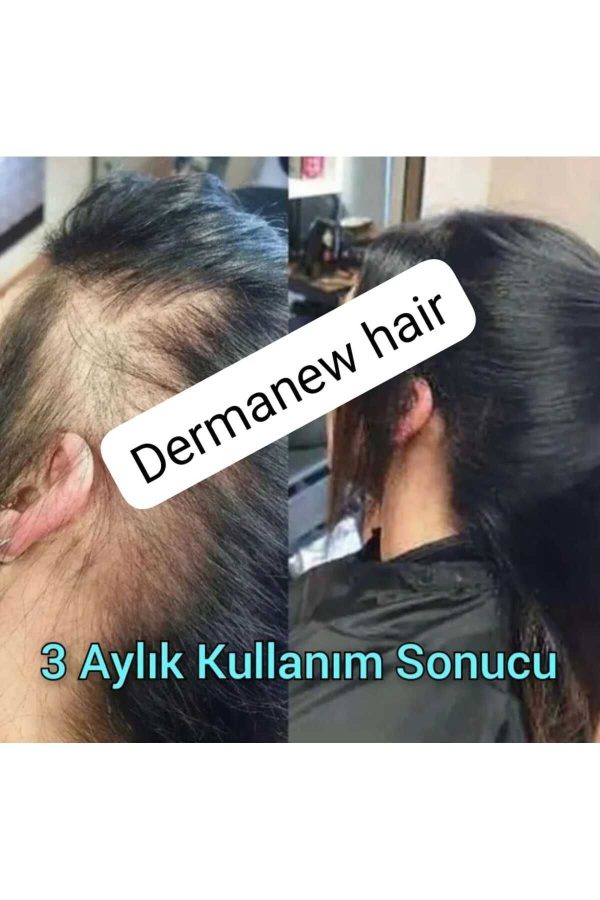 ست مراقبت از مو اورجینال برند Dermanew hair مدل Kadın Saç Gürleştirici Serum کد 127395872 - Image 2
