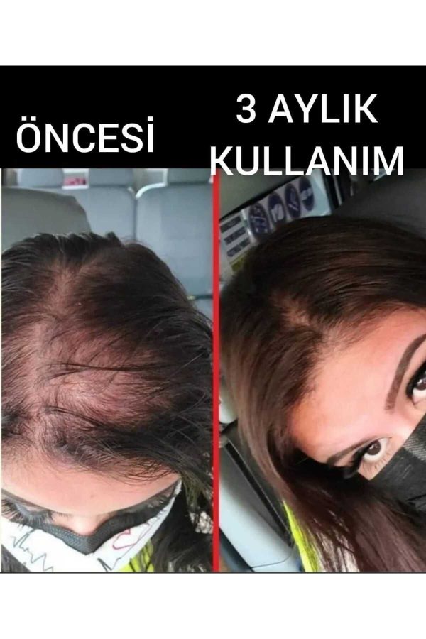 ست مراقبت از مو اورجینال برند Dermanew hair مدل Kadın Saç Gürleştirici Serum کد 127395872 - Image 4
