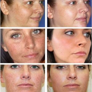 ست مراقبت از پوست اورجینال برند Meyar کد 867818402