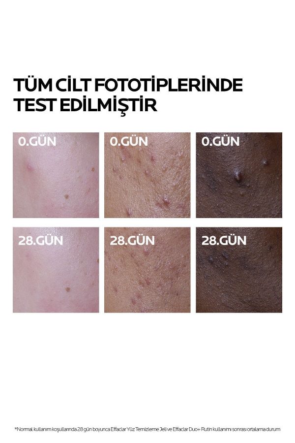 کرم صورت اورجینال برند La roche posay کد 859885270 - Image 3