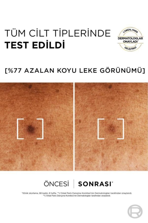 ست مراقبت از پوست اورجینال برند L oreal paris کد 818471948 - Image 3