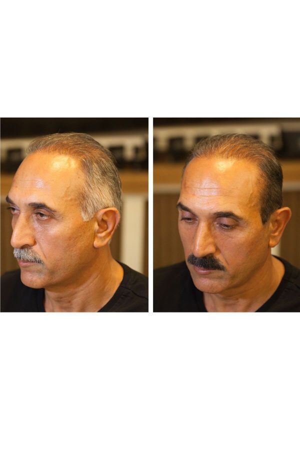 رنگ مو اورجینال برند Fixplant مدل Fixwhite Beyazlık Kapatıcı Rötuş Kalemi کد 847039215 - Image 4