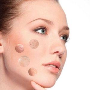 سرم پوست اورجینال برند Revolution skincare کد 832103828