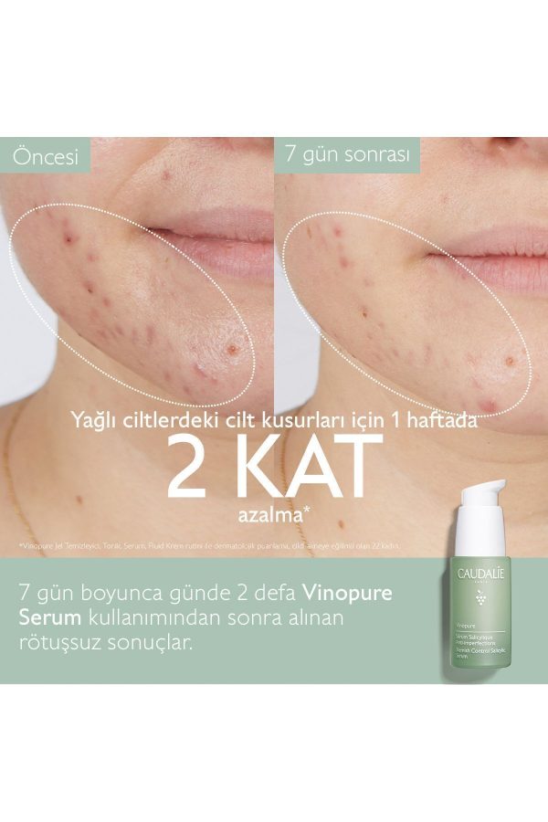 سرم پوست اورجینال برند Caudalie مدل Vinopure Salicylic Serum 30 ml کد 141737192 - Image 3