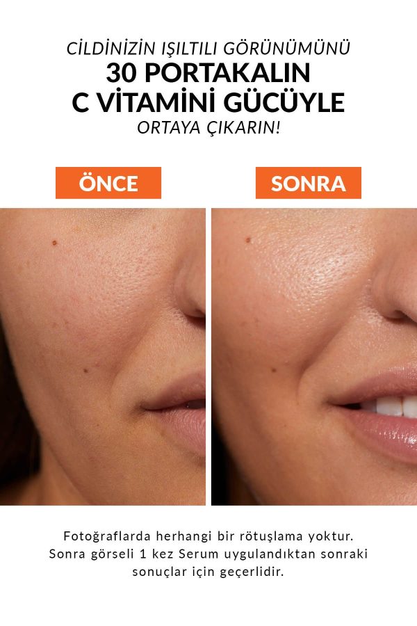 سرم پوست اورجینال برند Avon کد 856044762 - Image 3