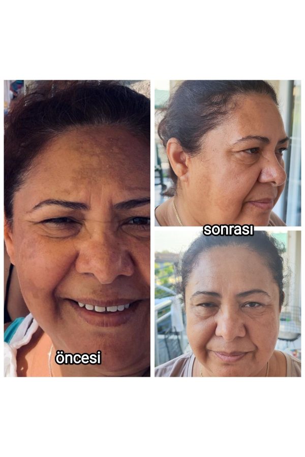کرم صورت اورجینال برند Eucerin کد 754011118 - Image 2
