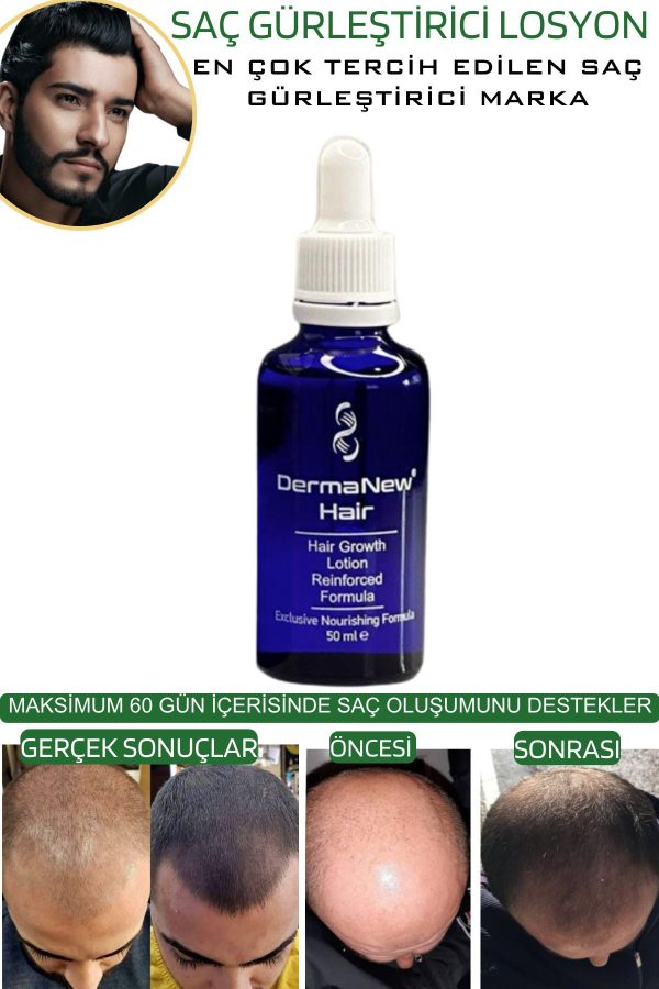 روغن و سرم مو اورجینال برند Dermanew hair کد 795524031 - Image 5