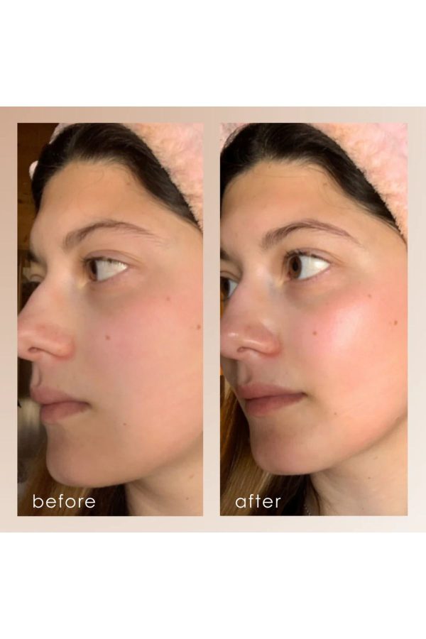 ست مراقبت از پوست اورجینال برند Project e beauty کد 828838859 - Image 5