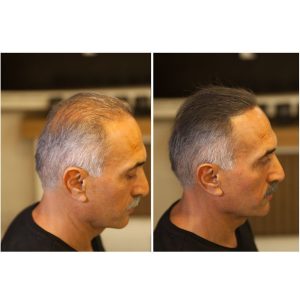 رنگ مو اورجینال برند Fixplant کد 846877661