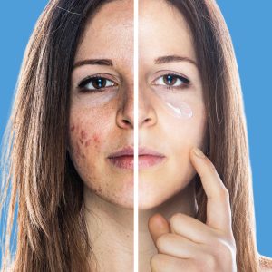 کرم صورت اورجینال برند Zederma مدل Onarıcı B5 Krem کد 700381390