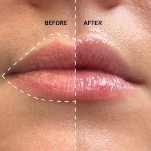 برق لب اورجینال برند The inkey list مدل Tripeptide Plumping Lip Balm کد 859109825