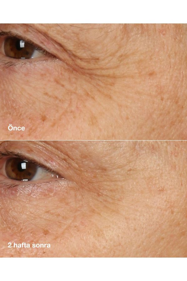 کرم صورت اورجینال برند Clinique مدل Repairing Night Cream & Mask کد 861653061 - Image 5