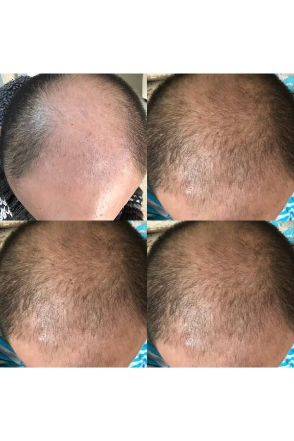 روغن و سرم مو اورجینال برند Mavi serum کد 349172004 - Image 6